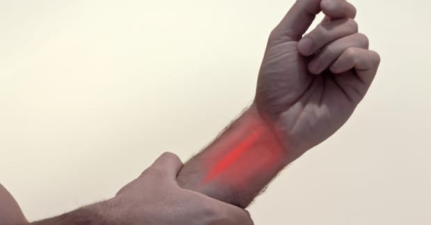 Carpal Tunnel Syndrome vs. A Pinched Nerve Elsewhere Dr. Matthew Dunn